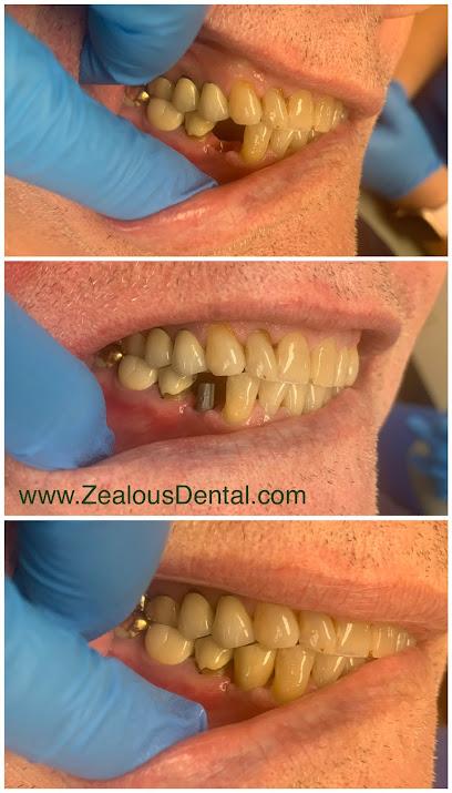 Zealous Dental Columbus - General dentist in Columbus, OH