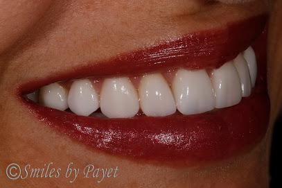 Smiles by Payet Dentistry - Cosmetic dentist in Charlotte, NC