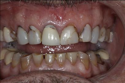 Pure Dental of Camarillo | Janna Gorinstein DDS - General dentist in Camarillo, CA