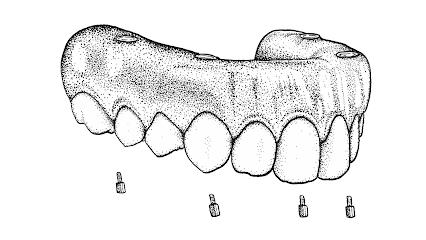 Doctors Implants - Oral surgeon in Oklahoma City, OK