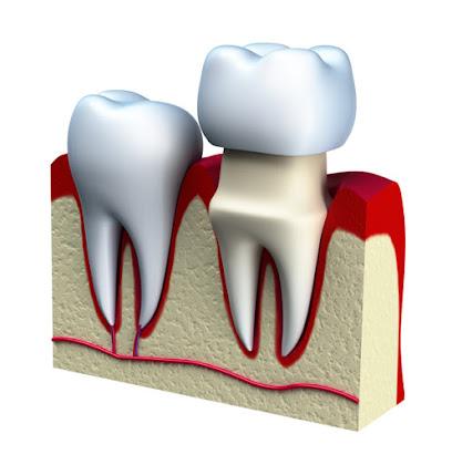 Periodontal Associates - Periodontist in Beaverton, OR