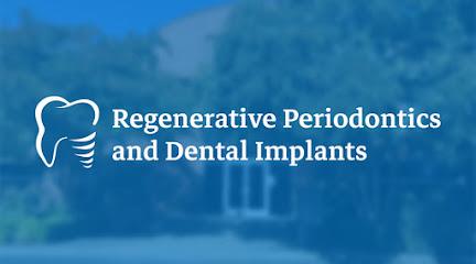 Regenerative Periodontics and Dental Implants - General dentist in Sacramento, CA