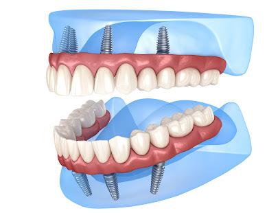 Westwind Dental South Mountain - General dentist in Phoenix, AZ