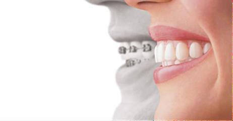 The Indianapolis Orthodontist - General dentist in Indianapolis, IN
