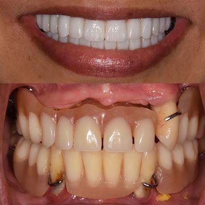 Jolie Smiles Denture & Implant Studio - General dentist in Odessa, FL