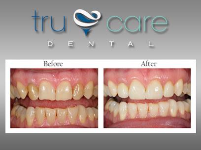 TruCare Dental - General dentist in Albuquerque, NM