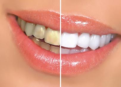 Modern Smiles - General dentist in North Hollywood, CA