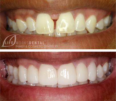 Lifeworks Dental - General dentist in Houston, TX