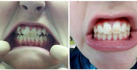 RS Orthodontics - Orthodontist in Martinsburg, WV