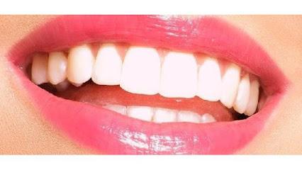 Smile Design - Cosmetic dentist in Little Falls, NJ