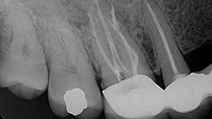 Precision Endodontics P.C. - Endodontist in Buffalo, NY