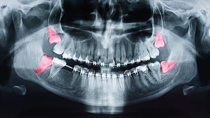 Purely Wisdom Teeth- Dental Surgery Center - Oral surgeon in Phoenix, AZ
