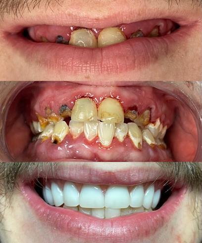 Inspire Dentistry – Pediatric Dentist | Family & Cosmetic | Veneers & Braces | Implants, Teeth Whitening, Botox in Canton, MI - General dentist in Canton, MI