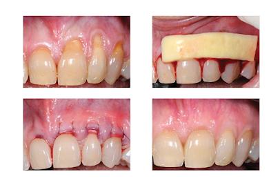 Harbor Implant and Cosmetic Dentistry - General dentist in Fullerton, CA
