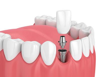 Nevada Dentistry & Braces - General dentist in Las Vegas, NV