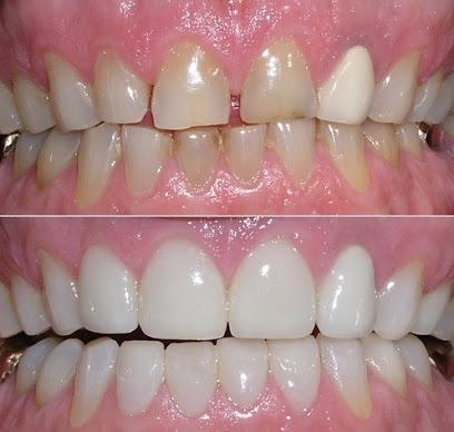 Dr. Kang Lee, DDS - General dentist in Hemet, CA