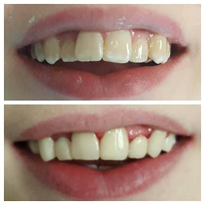 Dent-Al Smiles, Llc - Cosmetic dentist in Fairfield, OH