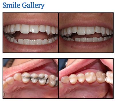 Columbus Family Dentistry – Mike Sagarian DDS in Bakersfield - General dentist in Bakersfield, CA