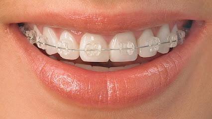 Angleton Orthodontist – James S. Henson D.D.S. - Orthodontist in Angleton, TX