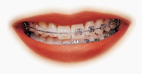 Chang DMD Orthodontics – Dr. Shiaw-Wei David Chang DMD - General dentist in Mc Lean, VA