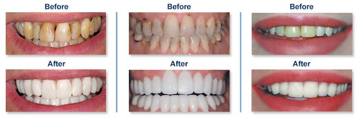 Lindsten Dentistry of Rockford - General dentist in Rockford, IL