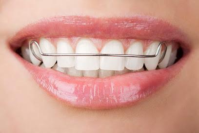 Teeth Retainer After Braces - General dentist in Brooklyn, NY