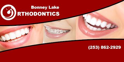 Bonney Lake Orthodontics – Dr. Isaac Fu, DDS, MSD, PLLC - Orthodontist in Bonney Lake, WA