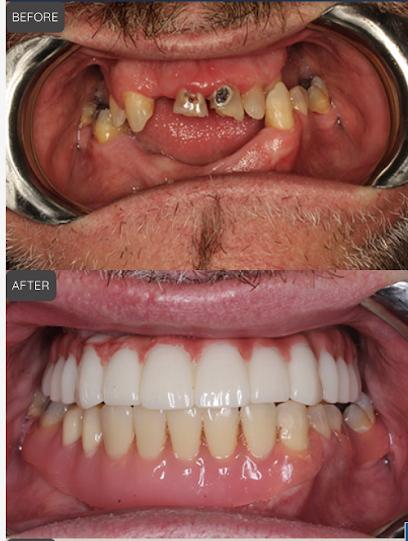 Streamline Dental Implants - General dentist in Las Vegas, NV