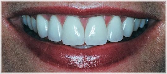 West LKN Dentistry, P.A. – Dental Implants Denver NC - General dentist in Denver, NC
