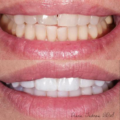 Beauty and the Teeth Dentistry: Dr. Diana Tadros DDS AAACD FICOI FAGD - General dentist in Fort Lauderdale, FL