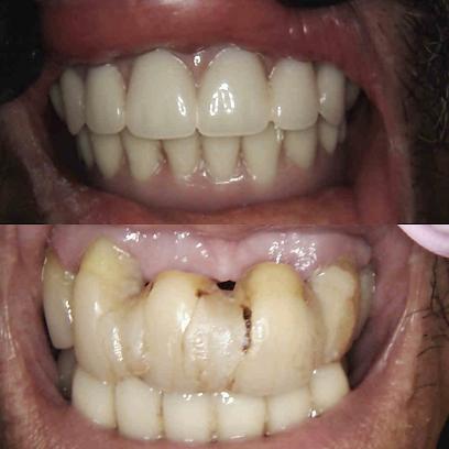 Smile Dental of New Rochelle - General dentist in New Rochelle, NY