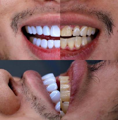 Dental Design Smile - General dentist in Miami, FL