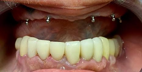 Rosewood Dental - General dentist in San Antonio, TX