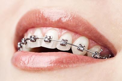 Castillo Dental Group Orthodontics & Implant Center - General dentist in San Jose, CA