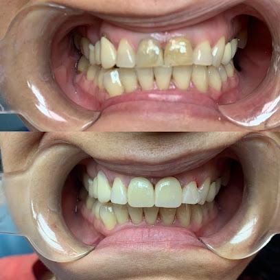 Batista Smile Design - General dentist in Miami, FL