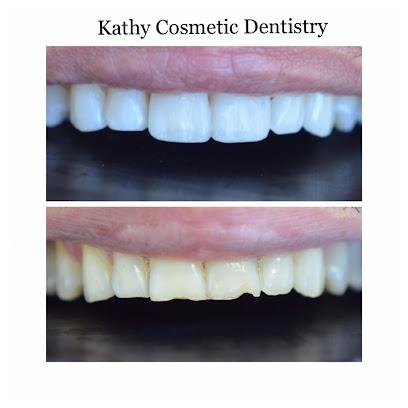 Kathy Cosmetic Dentistry - Cosmetic dentist, General dentist in Woodland Hills, CA