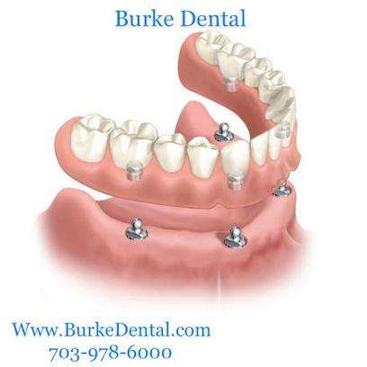 Burke Dental – Family & Cosmetic Dentist in Burke, VA - General dentist in Burke, VA