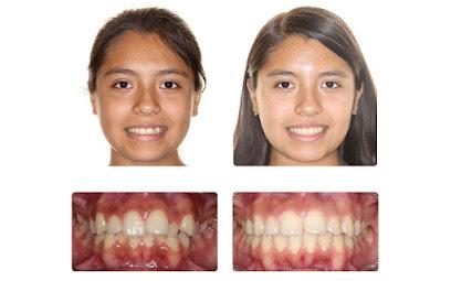 Gorczyca Orthodontics - Orthodontist in Antioch, CA