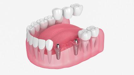 Seville Dental Family Implant - General dentist in Huntington Park, CA