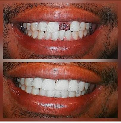 Smile32 Dental - General dentist in Stockton, CA
