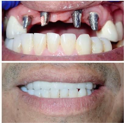 Complete Dental Works – Teaneck - General dentist in Teaneck, NJ