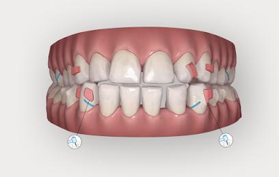 Bracetown Orthodontics, Dr. Gorenkoff, Dr.Zolnowski - Orthodontist in Holbrook, NY