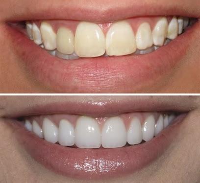Platinum Dental North Logan – Dr. Maxwell Doxey and Dr. Denim Arnoldson - General dentist in Logan, UT