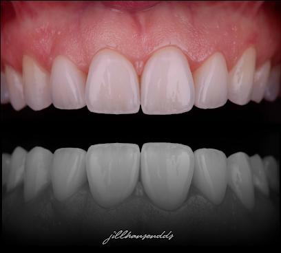 Spaulding Dental Co. - General dentist in Gig Harbor, WA