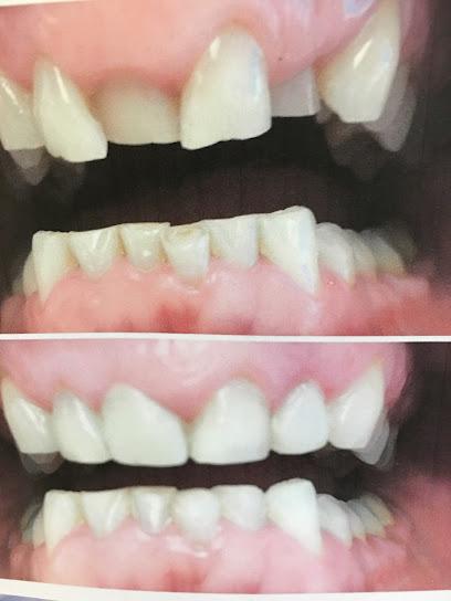 Dentist PC – I. Badzelewicz DDS, PhD. - Cosmetic dentist in Union, NJ