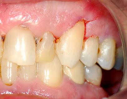 Anxiety Free Dental – Marc Gottlieb DDS - General dentist in Commack, NY