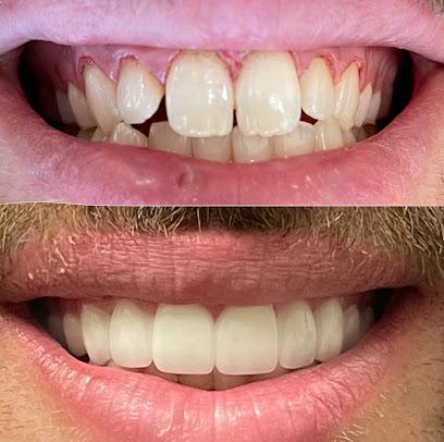 Lux Dental Spa – Dr. Laleh Mehrrafiee DDS - General dentist in Irvine, CA