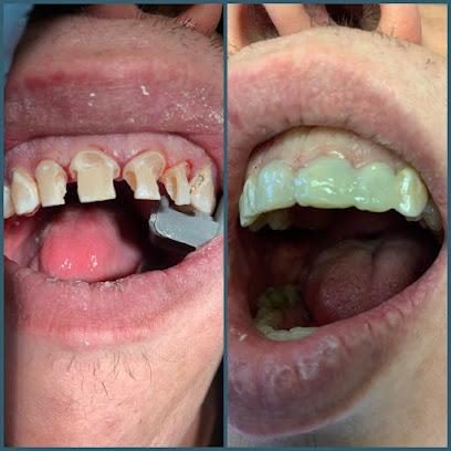 Restoration Dental - General dentist in Huntington Woods, MI