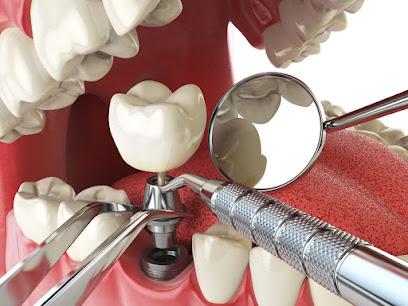 Affordable Dental Implants Morris County - Periodontist in Budd Lake, NJ
