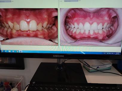 Advanced Orthodontics LLC - Orthodontist in Norwich, CT